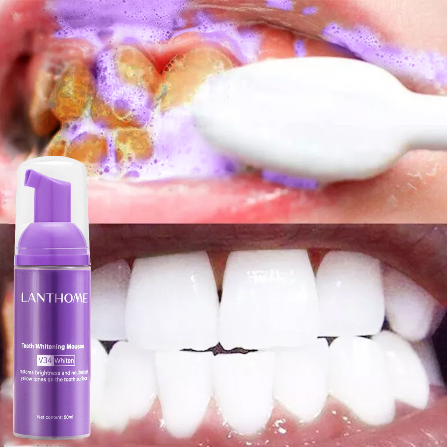 Teeth Whitening Xylitol - V34 Pasta Gigi Mousse Pemutih Gigi