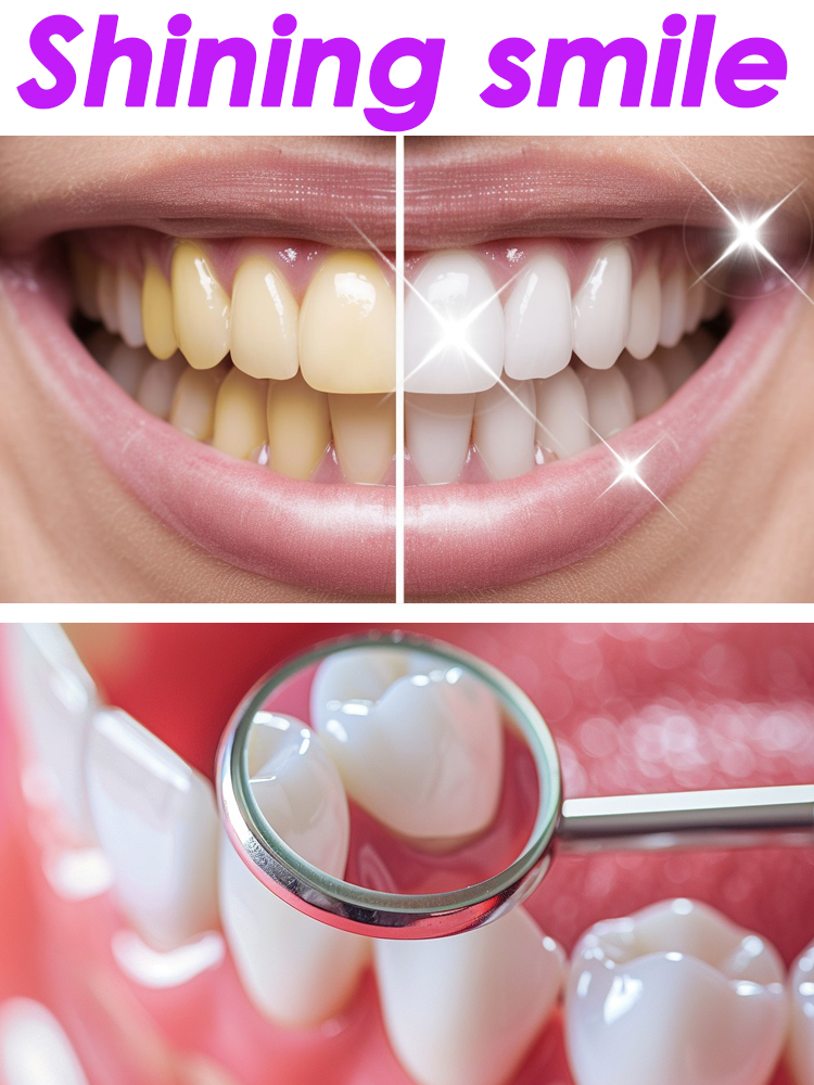 GlorySmile Produk Pasta Gigi B - Teeth Whitening Xylitol ulasan dan harga