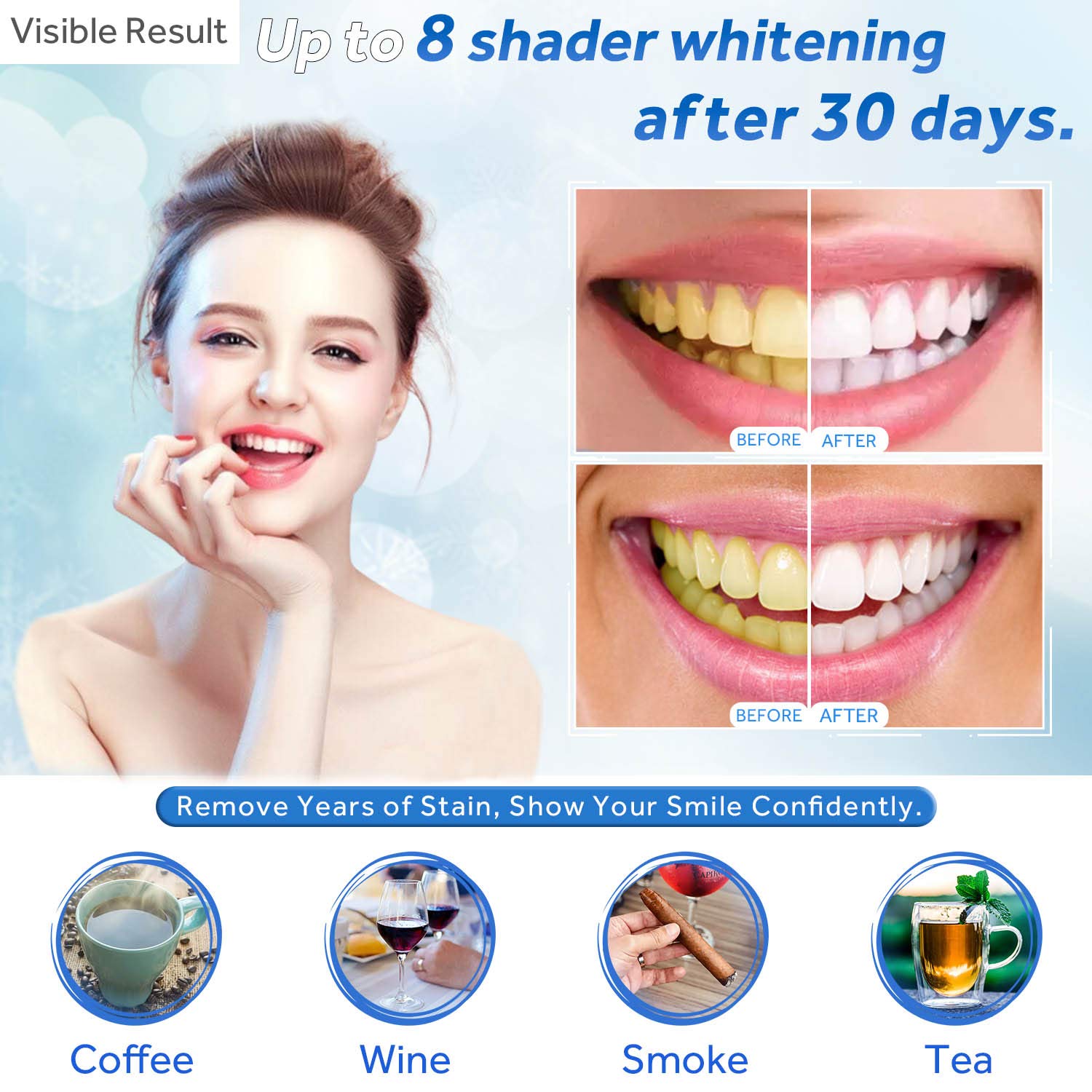 Gel Pemutih Gigi Isi Ulang Syr - Teeth Whitening From Home ulasan dan harga