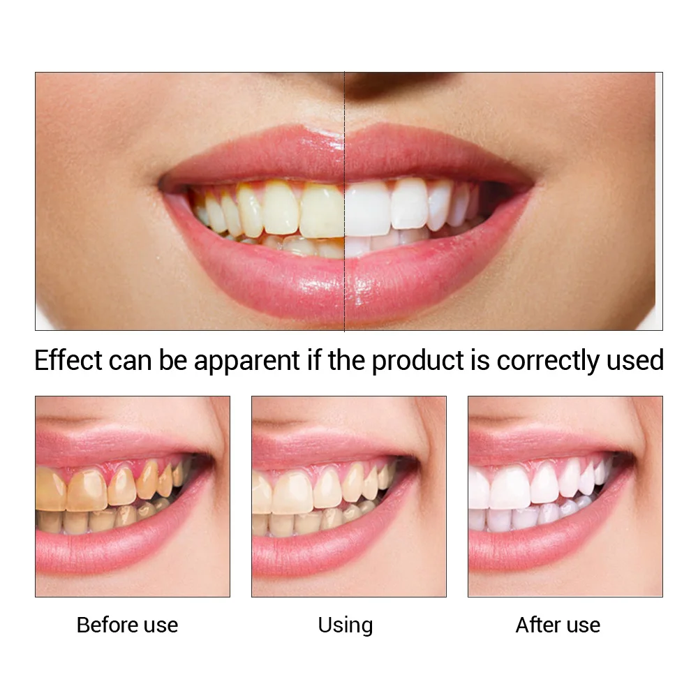 FTEENPLY Bubuk Esensi Pemutih  - Teeth Whitening From Home ulasan dan harga