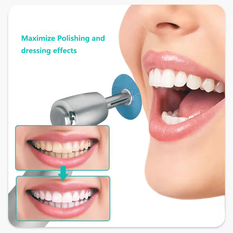 40 Buah Cakram Pemoles Gigi Ba - Teeth Whitening Uk ulasan dan harga