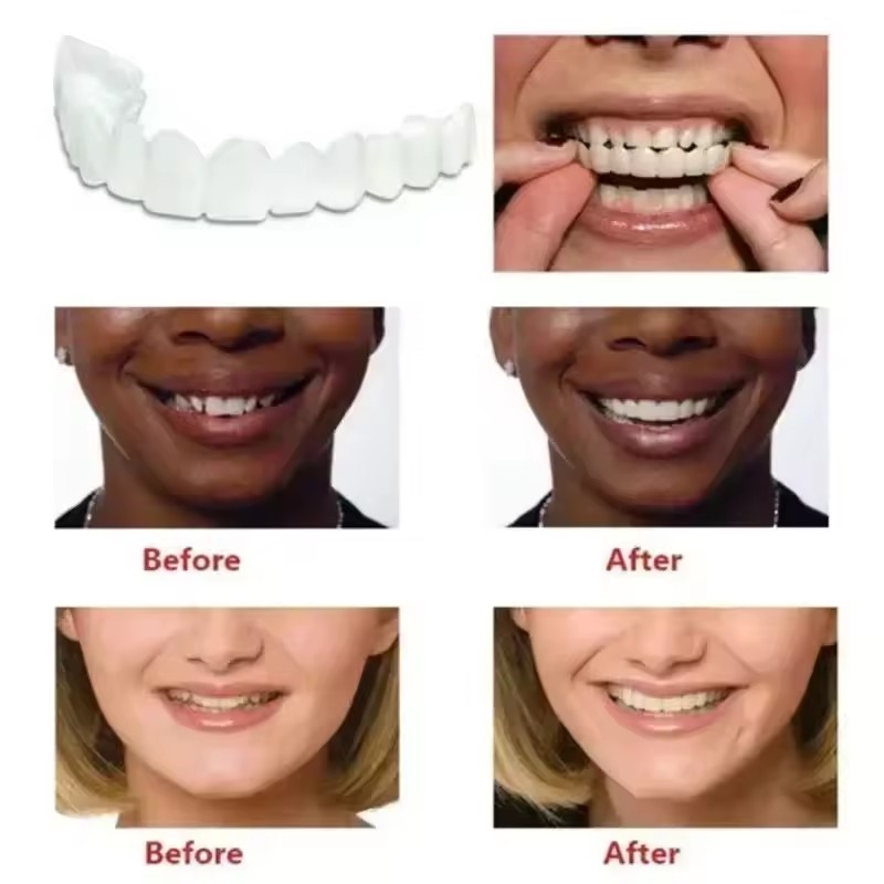 Veneer Gigi Pemutih Gigi Tirua - Teeth Whitening Vape ulasan dan harga