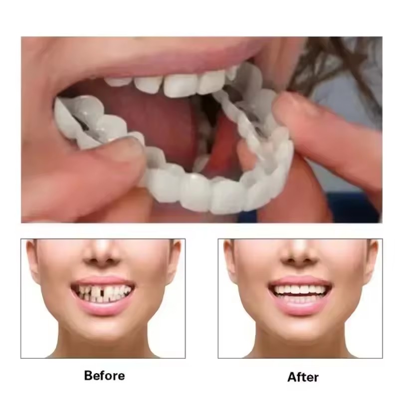 Veneer Gigi Pemutih Gigi Tirua - Teeth Whitening Vape ulasan dan harga