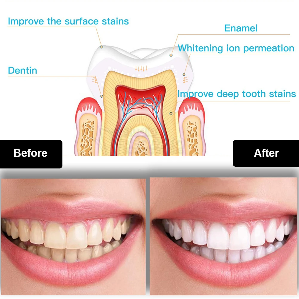 Kit pemutih gigi Mini 16 LED c - Teeth Whitening From Home ulasan dan harga
