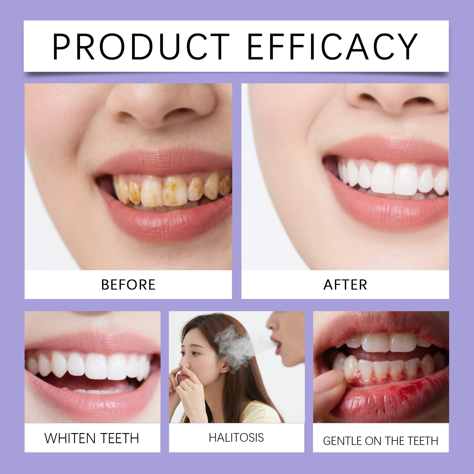 Obat Kumur Rasa Mint Alami War - Teeth Whitening Xylitol ulasan dan harga